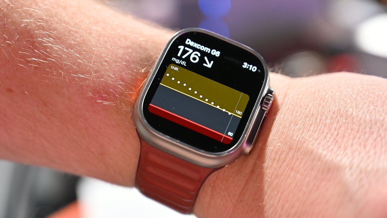 You are currently viewing Hands on: Using Dexcom G7 CGM directly with Apple Watch